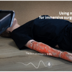Mixed Reality Is Transforming Burn Care Training with Project Ember